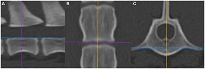 Evaluation of anatomic landmarks to increase precision performing a mini-hemilaminectomy—an ex vivo study in dogs